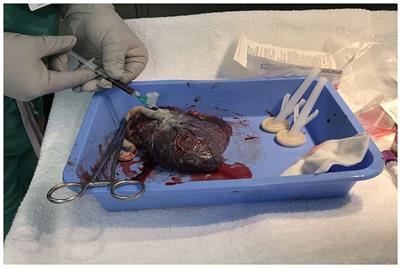 Suitability of Placental Blood Samples of Newborns for Pre-Transfusion Testing